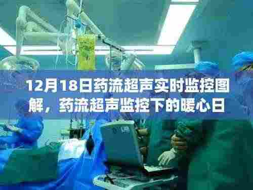 药流超声实时监控下的温馨时光,暖心日常与友共度时刻