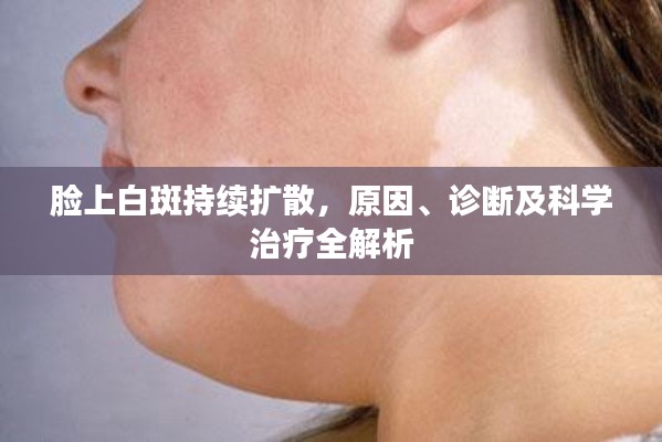脸上白斑持续扩散，原因、诊断及科学治疗全解析