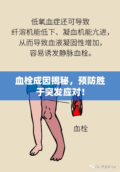 血栓成因揭秘，预防胜于突发应对！